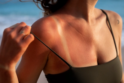Bronzage naturel progressif